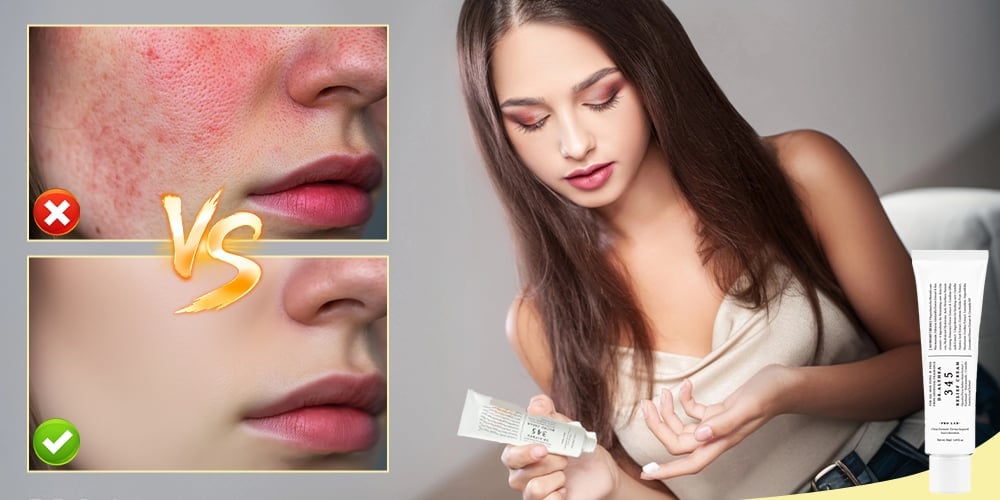 345 Relief Cream