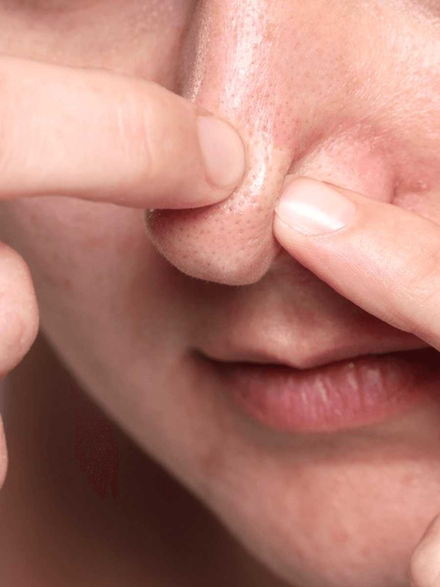 Nose Area