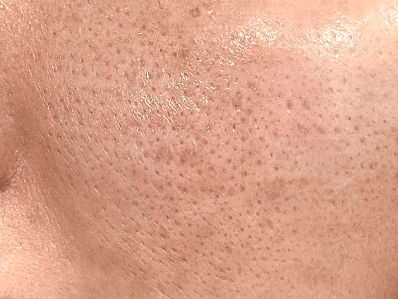 Coated pores