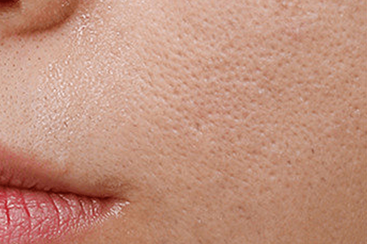 Before skin reset