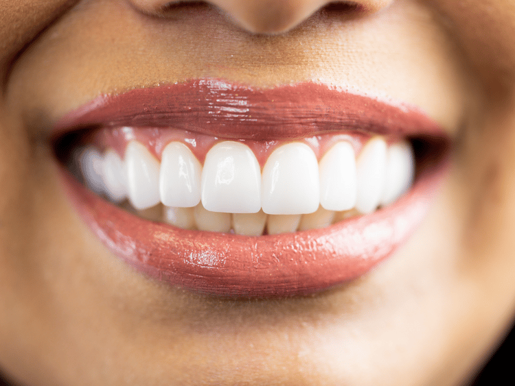 Whiten