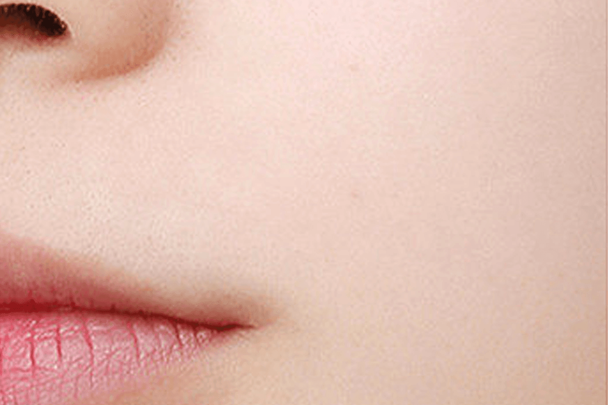 After skin reset